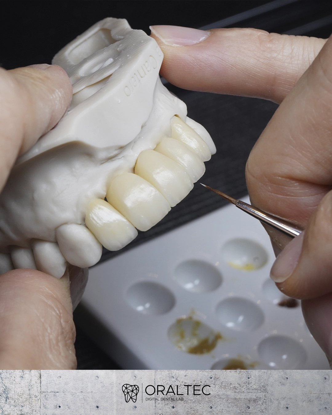 ORALTEC_laboratorio_Dental_Cali_01