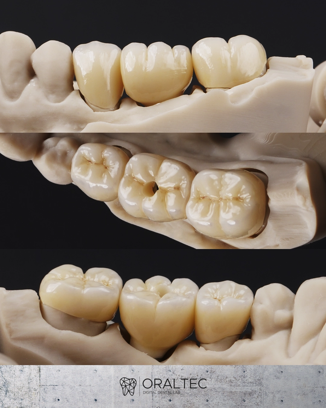 ORALTEC_laboratorio_Dental_Cali_02