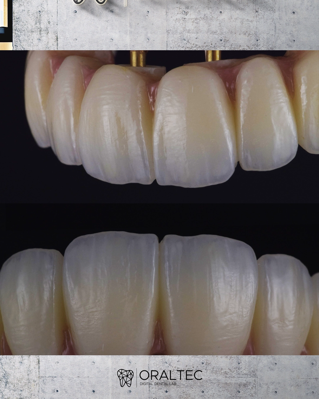 ORALTEC_laboratorio_Dental_Cali_03