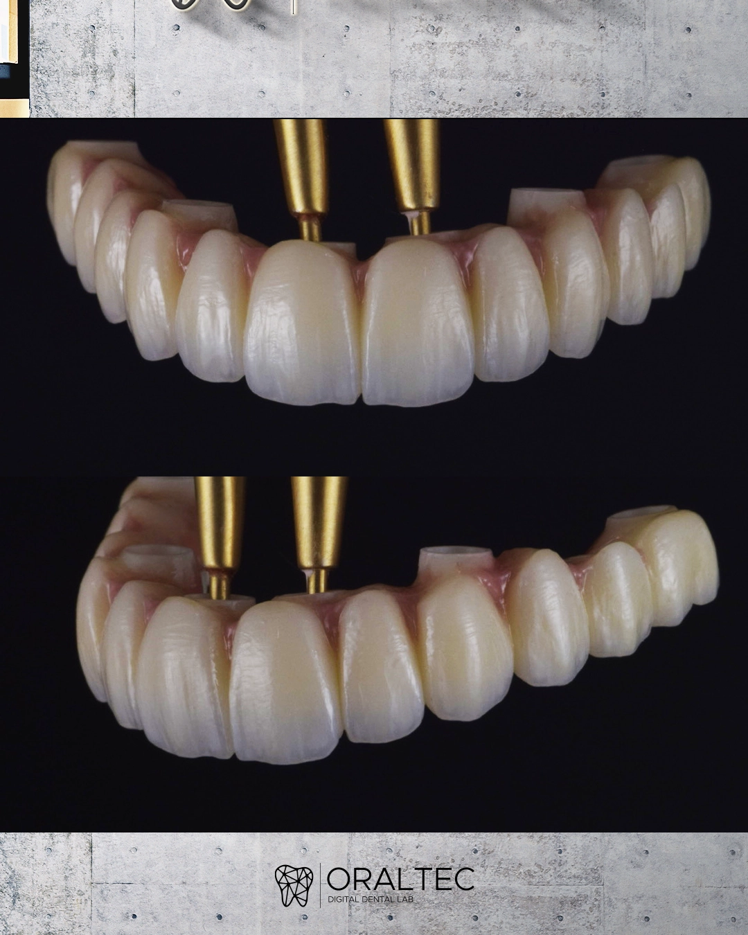 ORALTEC_laboratorio_Dental_Cali_04