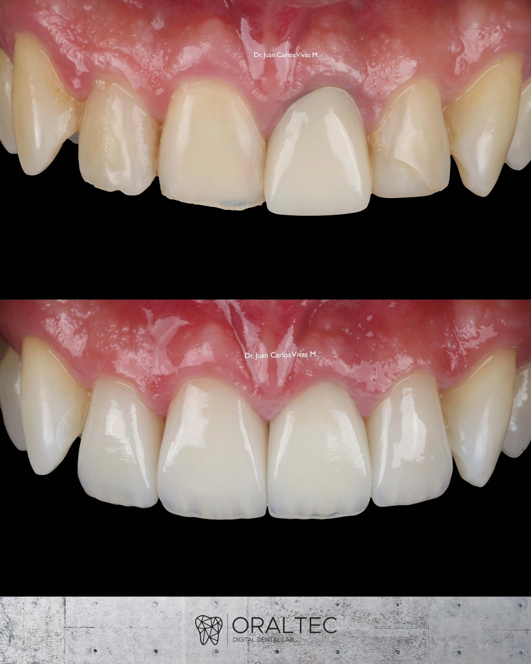 ORALTEC_laboratorio_Dental_Cali_05