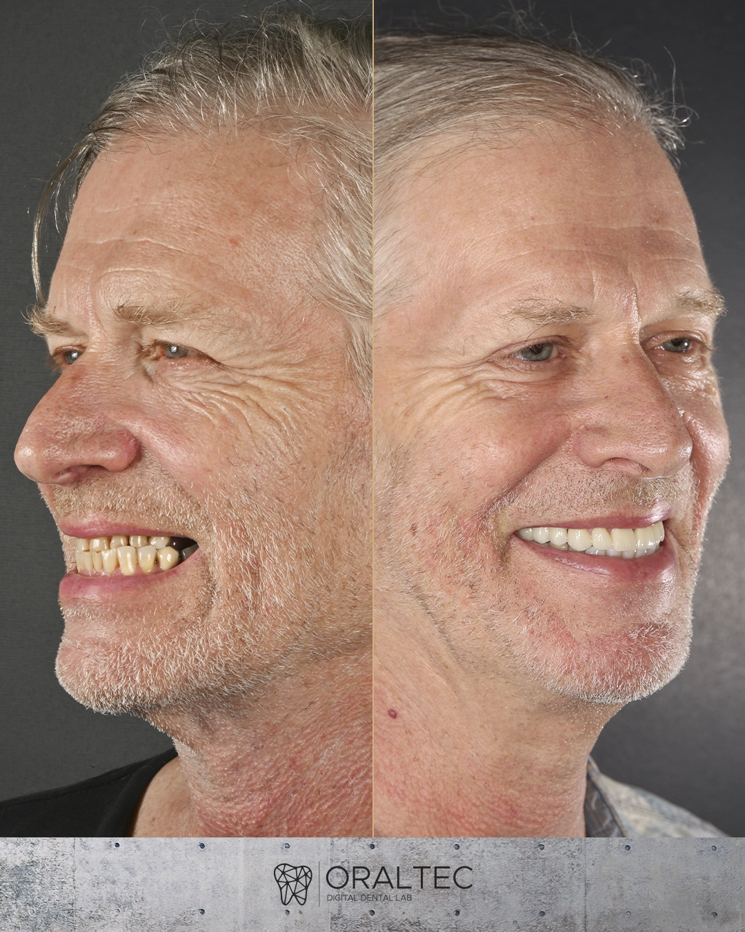 ORALTEC_laboratorio_Dental_Cali_06