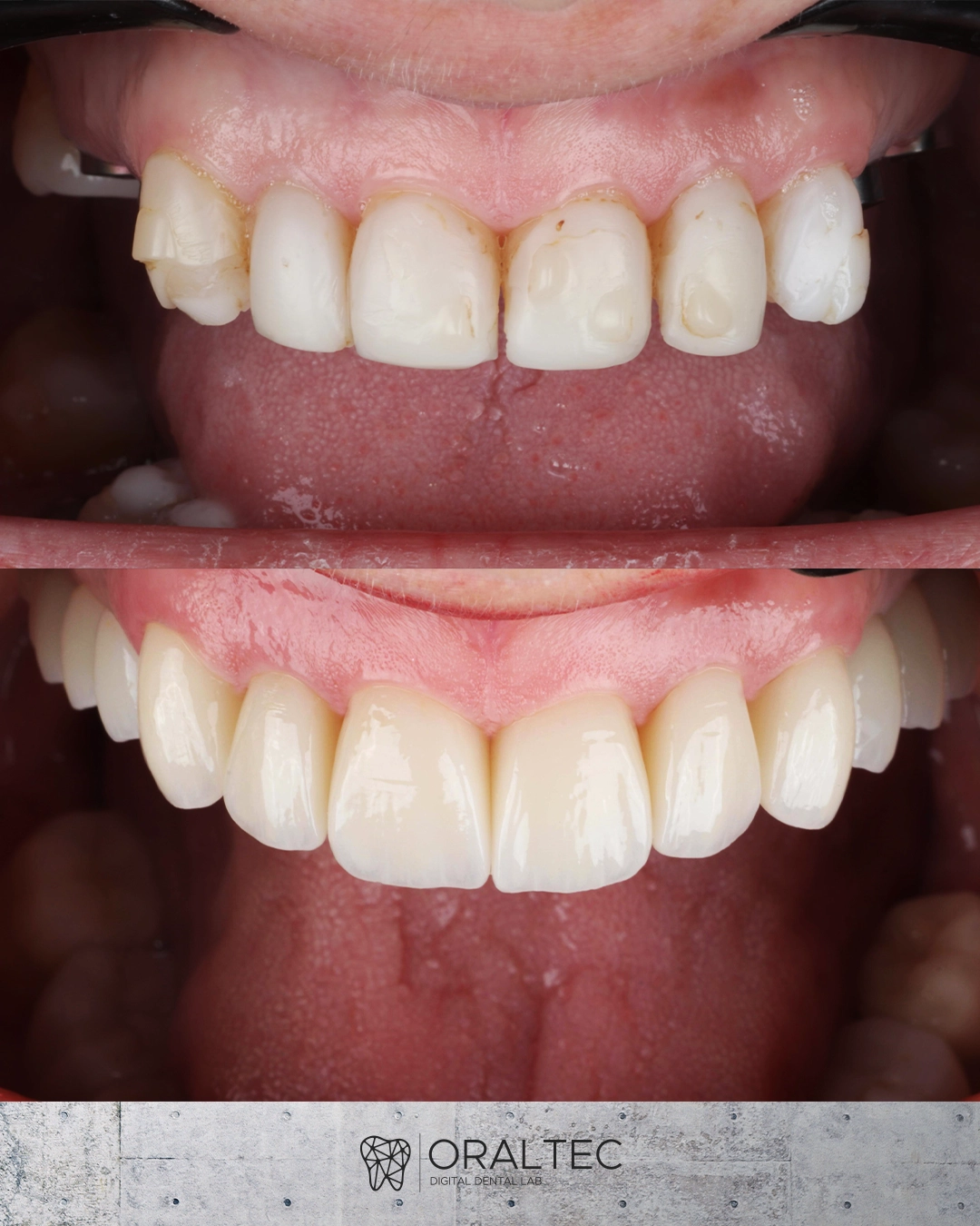 ORALTEC_laboratorio_Dental_Cali_08